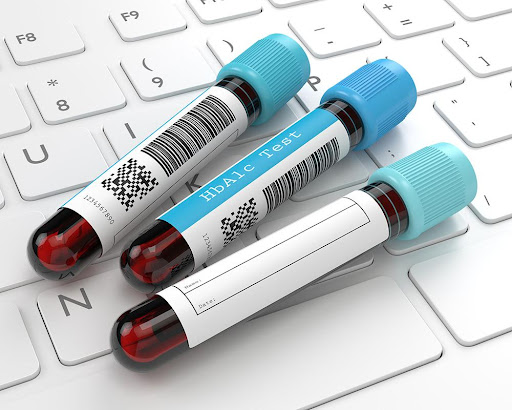 HBA1c-3 Blood Vialsi article