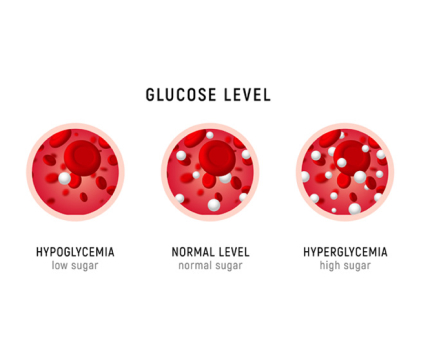 What To Do if Blood Glucose is Low